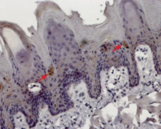 Anti-TRPM5 antibody used in IHC (Paraffin sections) (IHC-P). GTX54864