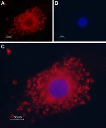 Anti-Polycystin 2 antibody used in Immunocytochemistry/ Immunofluorescence (ICC/IF). GTX54867