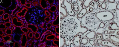 Anti-Polycystin 2 antibody used in IHC (Paraffin sections) (IHC-P). GTX54867