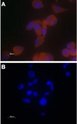 Anti-TRPV6 antibody used in Immunocytochemistry/ Immunofluorescence (ICC/IF). GTX54869