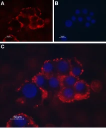 Anti-TRPC1 antibody used in Live cell imaging (LCI). GTX54876