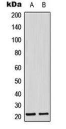 Anti-Adrenomedullin antibody used in Western Blot (WB). GTX54943