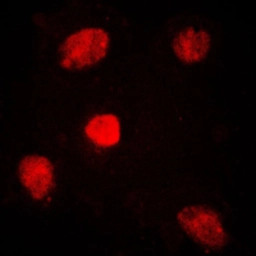 Anti-MED1 antibody used in Immunocytochemistry/ Immunofluorescence (ICC/IF). GTX55164