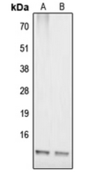 Anti-COX17 antibody used in Western Blot (WB). GTX55188