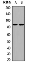 Anti-Cadherin 19 antibody used in Western Blot (WB). GTX55258