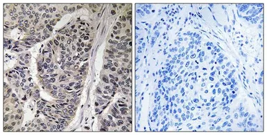 Anti-p130Cas (phospho Tyr410) antibody used in IHC (Paraffin sections) (IHC-P). GTX55306