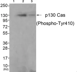 Anti-p130Cas (phospho Tyr410) antibody used in Western Blot (WB). GTX55306