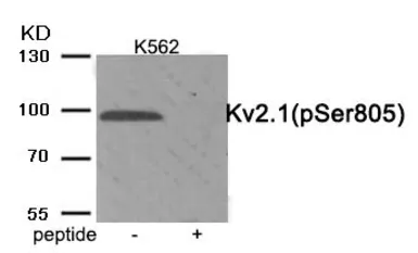 Anti-Kv2.1 (phospho Ser805) antibody used in Western Blot (WB). GTX55387