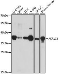Anti-AKR1C3 antibody used in Western Blot (WB). GTX55499