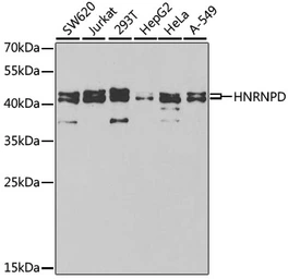 Anti-AUF1 antibody used in Western Blot (WB). GTX55526