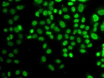 Anti-AUF1 antibody used in Immunocytochemistry/ Immunofluorescence (ICC/IF). GTX55526