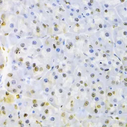 Anti-AUF1 antibody used in IHC (Paraffin sections) (IHC-P). GTX55526