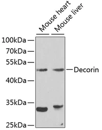 Anti-Decorin antibody used in Western Blot (WB). GTX55587