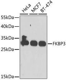 Anti-FKBP25 antibody used in Western Blot (WB). GTX55625