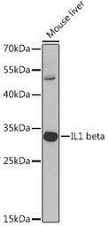 Anti-IL1 beta antibody used in Western Blot (WB). GTX55675