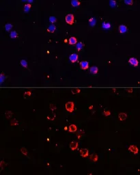 Anti-IL1 beta antibody used in Immunocytochemistry/ Immunofluorescence (ICC/IF). GTX55675