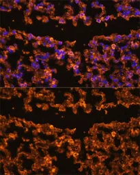 Anti-IL1 beta antibody used in IHC (Paraffin sections) (IHC-P). GTX55675