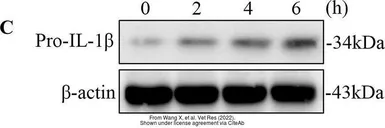 Anti-IL1 beta antibody used in Western Blot (WB). GTX55675