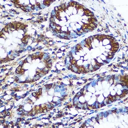 Anti-nm23-H1 antibody used in IHC (Paraffin sections) (IHC-P). GTX55727