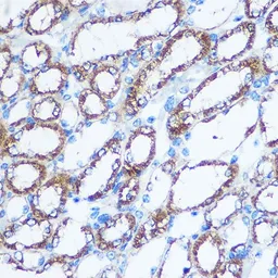 Anti-nm23-H1 antibody used in IHC (Paraffin sections) (IHC-P). GTX55727