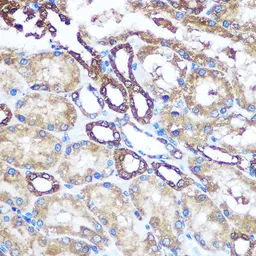 Anti-nm23-H1 antibody used in IHC (Paraffin sections) (IHC-P). GTX55727