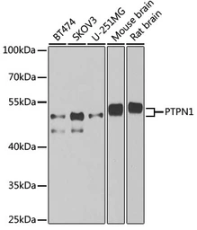 Anti-PTP1B antibody used in Western Blot (WB). GTX55767