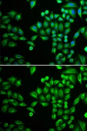 Anti-PTP1B antibody used in Immunocytochemistry/ Immunofluorescence (ICC/IF). GTX55767