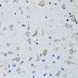 Anti-PTP1B antibody used in IHC (Paraffin sections) (IHC-P). GTX55767