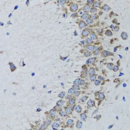 Anti-PTP1B antibody used in IHC (Paraffin sections) (IHC-P). GTX55767