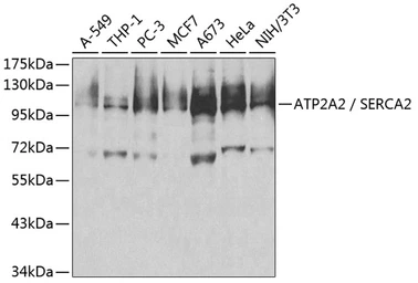 Anti-SERCA2 ATPase antibody used in Western Blot (WB). GTX55790