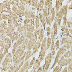 Anti-SERCA2 ATPase antibody used in Immunocytochemistry/ Immunofluorescence (ICC/IF). GTX55790