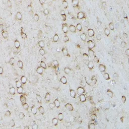 Anti-SERCA2 ATPase antibody used in IHC (Paraffin sections) (IHC-P). GTX55790