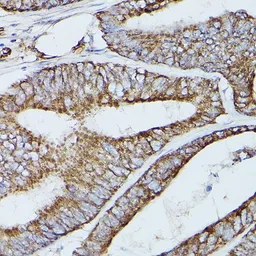 Anti-SERCA2 ATPase antibody used in IHC (Paraffin sections) (IHC-P). GTX55790