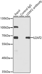 Anti-U2AF65 antibody used in Immunoprecipitation (IP). GTX55828