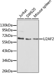 Anti-U2AF65 antibody used in Western Blot (WB). GTX55828