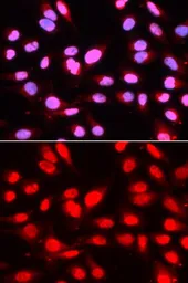 Anti-U2AF65 antibody used in Immunocytochemistry/ Immunofluorescence (ICC/IF). GTX55828