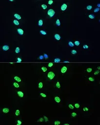 Anti-UAP56 antibody used in Immunocytochemistry/ Immunofluorescence (ICC/IF). GTX55829