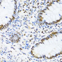 Anti-UAP56 antibody used in IHC (Paraffin sections) (IHC-P). GTX55829