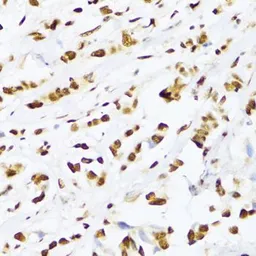 Anti-UAP56 antibody used in IHC (Paraffin sections) (IHC-P). GTX55829