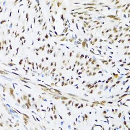 Anti-UAP56 antibody used in IHC (Paraffin sections) (IHC-P). GTX55829