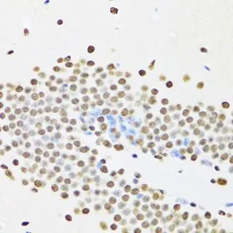 Anti-UAP56 antibody used in IHC (Paraffin sections) (IHC-P). GTX55829