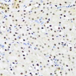 Anti-UAP56 antibody used in IHC (Paraffin sections) (IHC-P). GTX55829