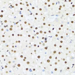 Anti-UAP56 antibody used in IHC (Paraffin sections) (IHC-P). GTX55829