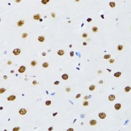 Anti-UAP56 antibody used in IHC (Paraffin sections) (IHC-P). GTX55829