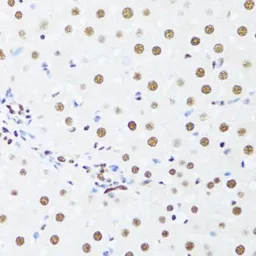 Anti-UAP56 antibody used in IHC (Paraffin sections) (IHC-P). GTX55829