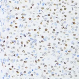 Anti-UAP56 antibody used in IHC (Paraffin sections) (IHC-P). GTX55829