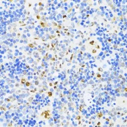 Anti-UAP56 antibody used in IHC (Paraffin sections) (IHC-P). GTX55829