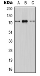 Anti-CNT1 antibody used in Western Blot (WB). GTX55912