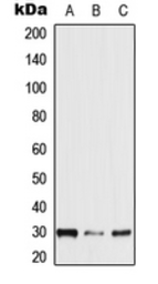 Anti-NXPH2 antibody used in Western Blot (WB). GTX55932