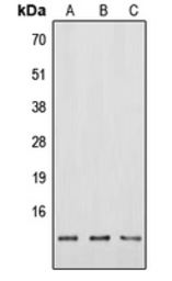 Anti-Neuromedin B antibody used in Western Blot (WB). GTX55995